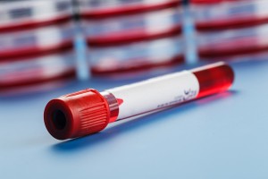 leucemia